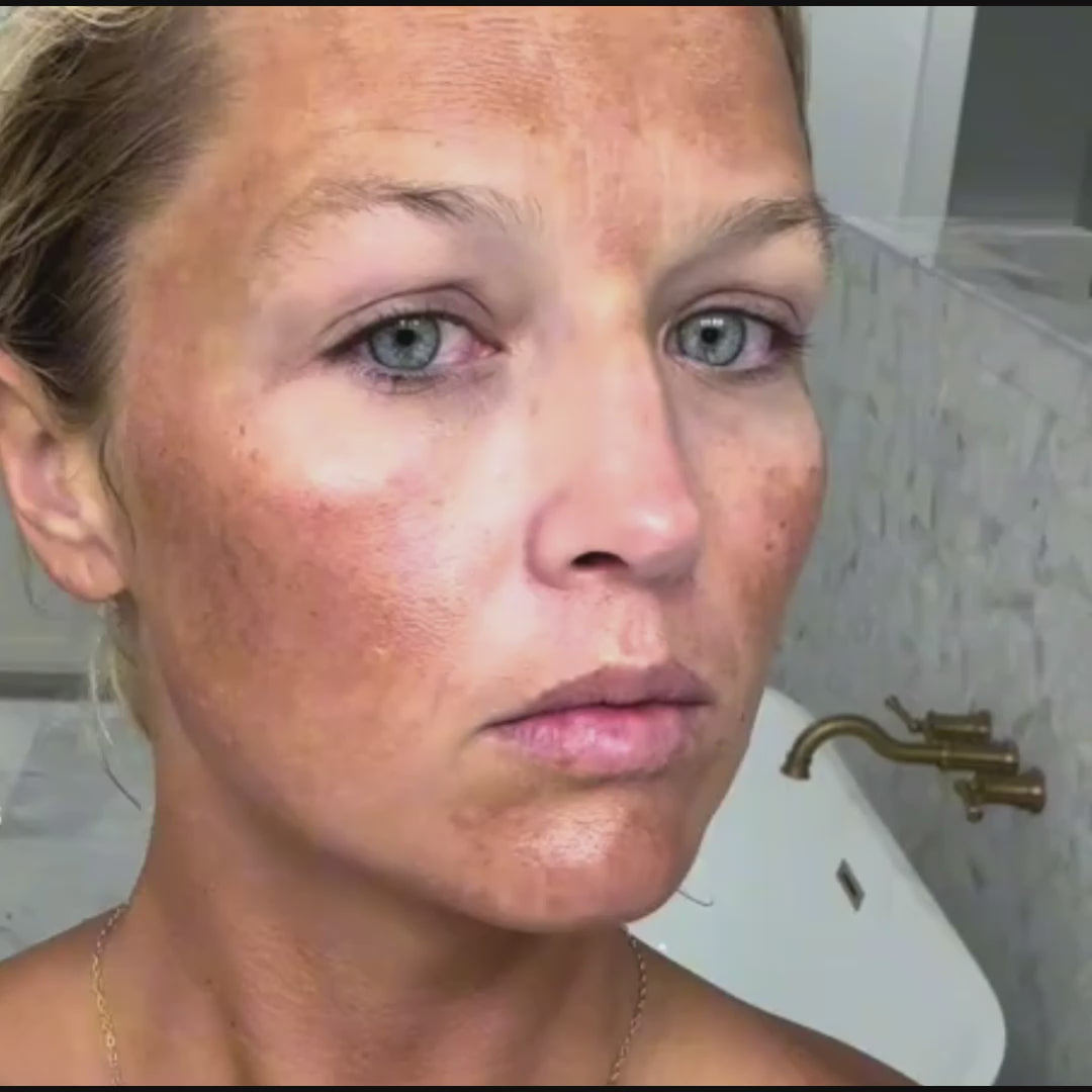 Săpun cu Turmeric și ACID Kojic